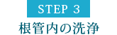 STEP3 根管内の洗浄